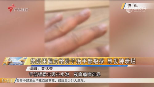 新冠连续3周居门急诊流感样病例首位